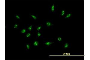 Immunofluorescence of purified MaxPab antibody to XAGE2 on HeLa cell. (XAGE2 anticorps  (AA 1-111))