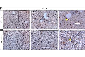 Expression of genes and proteins related to Hh signaling in SLC mice.