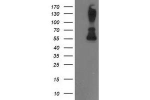 Western Blotting (WB) image for anti-Protein Phosphatase, Mg2+/Mn2+ Dependent, 1B (PPM1B) antibody (ABIN1500374) (PPM1B anticorps)