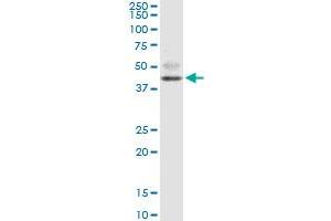 FOXF2 monoclonal antibody (M08), clone 3D11. (FOXF2 anticorps  (AA 346-443))