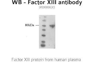Image no. 1 for anti-Coagulation Factor XIII, A1 Polypeptide (F13A1) antibody (ABIN347012) (F13A1 anticorps)