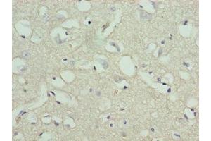 Immunohistochemistry of paraffin-embedded human brain tissue using ABIN7170811 at dilution of 1:100