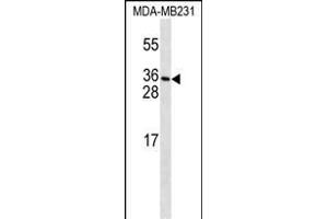 PDGFC Antibody (T89) (ABIN650654 and ABIN2837869) western blot analysis in MDA-M cell line lysates (35 μg/lane). (PDGFC anticorps  (N-Term))