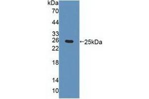 Detection of Recombinant CHRNa4, Human using Polyclonal Antibody to Cholinergic Receptor, Nicotinic, Alpha 4 (CHRNa4)