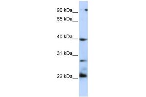 TNFRSF10B antibody (70R-10433) used at 0.