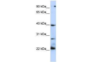 TNFRSF10B antibody (70R-10433) used at 0. (TNFRSF10B anticorps  (N-Term))