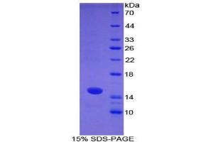 SDS-PAGE (SDS) image for S100 Calcium Binding Protein A7 (S100A7) (AA 1-108) protein (His tag) (ABIN1878099) (S100A7 Protein (AA 1-108) (His tag))
