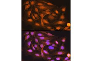 Immunofluorescence analysis of U-2 OS cells using ISG15 Rabbit mAb (ABIN7268023) at dilution of 1:100 (40x lens).
