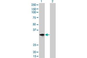 Western Blot analysis of CCND2 expression in transfected 293T cell line by CCND2 monoclonal antibody (M01), clone 3B10. (Cyclin D2 anticorps  (AA 190-289))