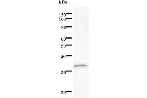 Western Blotting (WB) image for anti-DEAD (Asp-Glu-Ala-Asp) Box Polypeptide 17 (DDX17) antibody (ABIN933152) (DDX17 anticorps)