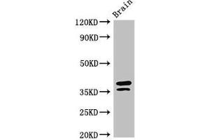Western Blot Positive WB detected in: Mouse brain tissue All lanes: MAPRE2 antibody at 3 μg/mL Secondary Goat polyclonal to rabbit IgG at 1/50000 dilution Predicted band size: 38, 30, 36, 33, 31 kDa Observed band size: 38, 36 kDa (MAPRE2 anticorps  (AA 159-240))