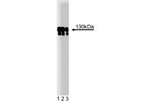 Western blot analysis of p130 [Cas] on a human endothelial cell lysate. (BCAR1 anticorps  (AA 644-819))