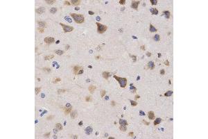 Immunohistochemistry of paraffin-embedded rat brain tissue using KPNA4 antibody at dilution of 1:200 (x400 lens).
