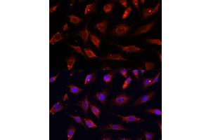 Immunofluorescence analysis of C6 cells using DNL1 antibody (ABIN6130967, ABIN6139736, ABIN6139738 and ABIN6217037) at dilution of 1:100. (DNASEX anticorps  (AA 1-302))