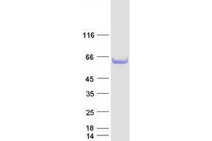 Validation with Western Blot