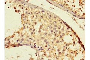Immunohistochemistry of paraffin-embedded human testis tissue using ABIN7172144 at dilution of 1:100 (THADA anticorps  (AA 432-651))