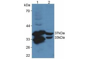 Figure. (CYR61 anticorps  (AA 176-379))