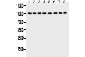 Western Blotting (WB) image for anti-Membrane Metallo-Endopeptidase (MME) (AA 52-750) antibody (ABIN3043879)