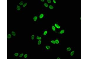 Immunofluorescence staining of Hela cells with ABIN7127601 at 1:38, counter-stained with DAPI.