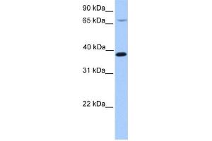 WB Suggested Anti-HMBS Antibody Titration: 0. (HMBS anticorps  (N-Term))