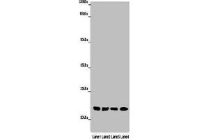 Western blot All lanes: ABHD14B antibody at 16 μg/mL Lane 1: Mouse small intestine tissue Lane 2: Mouse spleen tissue Lane 3: Mouse liver tissue Lane 4: Mouse lung tissue Secondary Goat polyclonal to rabbit IgG at 1/10000 dilution Predicted band size: 23, 19 kDa Observed band size: 23 kDa (ABHD14B anticorps  (AA 2-210))