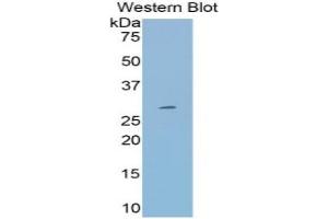 WB of Protein Standard: different control antibodies against Highly purified E.