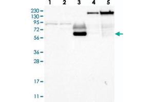 Western blot analysis of Lane 1: RT-4, Lane 2: U-251 MG, Lane 3: Human Plasma, Lane 4: Liver, Lane 5: Tonsil with ECM1 polyclonal antibody . (ECM1 anticorps)
