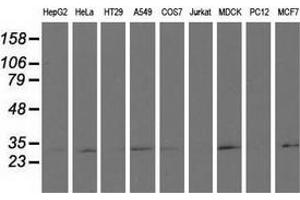 Western blot analysis of extracts (35 µg) from 9 different cell lines by using anti-RASD2 monoclonal antibody.