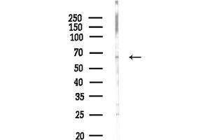 anti-Copine VI (CPNE6) (Internal Region) antibody