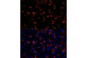 Immunofluorescence analysis of U-2 OS cells using CCDC47 antibody (ABIN7266438) at dilution of 1:100. (CCDC47 anticorps  (AA 224-483))