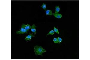 IF analysis of Elafin/Skalp using antiElafin/Skalp antibody (ABIN4886694). (PI3 anticorps  (AA 61-117))