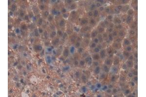 Detection of MYH6 in Rat Liver Tissue using Polyclonal Antibody to Myosin Heavy Chain 6, Cardiac Muscle, Alpha (MYH6)