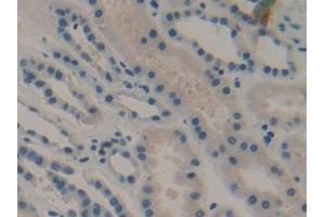 Detection of DKK1 in Human Kidney Tissue using Monoclonal Antibody to Dickkopf Related Protein 1 (DKK1)