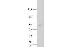 Validation with Western Blot