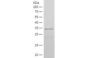Western Blotting (WB) image for Nestin (NES) (AA 1036-1253) protein (His tag) (ABIN7124134)