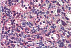 anti-Septin 8 (SEPT8) (AA 1-259) antibody