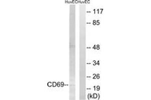 Western blot analysis of extracts from HuvEc cells, using CD69 Antibody. (CD69 anticorps  (AA 101-150))