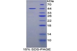 SDS-PAGE (SDS) image for Mucosae Associated Epithelia Chemokine (AA 29-131) protein (His tag,GST tag) (ABIN1879018)