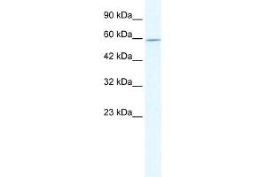 WB Suggested Anti-DDX47 Antibody Titration:  2. (DDX47 anticorps  (N-Term))