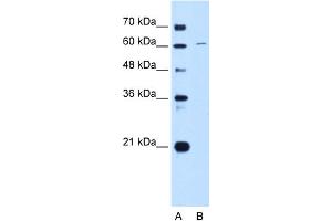 WB Suggested Anti-CDT1 Antibody Titration:  0. (CDT1 anticorps  (C-Term))