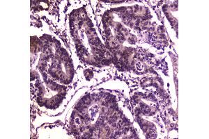 IHC analysis of BRG1 using anti-BRG1 antibody .
