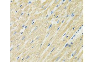 Immunohistochemistry of paraffin-embedded Rat heart using SLC19A1 Polyclonal Antibody at dilution of 1:100 (40x lens).