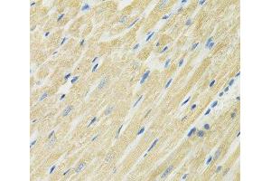 Immunohistochemistry of paraffin-embedded Rat heart using SLC19A1 Polyclonal Antibody at dilution of 1:100 (40x lens). (SLC19A1 anticorps)