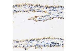 Immunohistochemistry of paraffin-embedded human prostate using SPINT1 antibody (ABIN5973812) at dilution of 1/100 (40x lens). (SPINT1 anticorps)