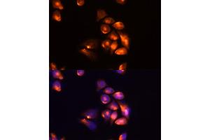 Immunofluorescence analysis of Hela cells using TIM-3/H antibody (ABIN6134185, ABIN6141626, ABIN6141630 and ABIN6217441) at dilution of 1:100 (40x lens). (TIM3 anticorps  (AA 1-100))