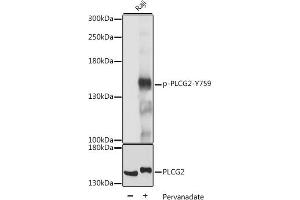 Western blot analysis of extracts of Raji cells, using Phospho-PLC gamma 2 (PLCG2)-Y759 antibody (ABIN7269341) at 1:2000 dilution or PLC gamma 2 (PLCG2) antibody (ABIN3023144, ABIN3023145, ABIN3023146 and ABIN6219411). (Phospholipase C gamma 2 anticorps  (pTyr759))