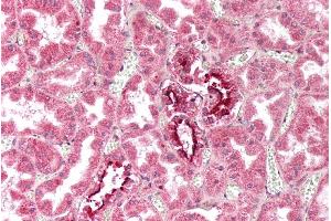 anti-Interferon-Induced Transmembrane Protein 3 (IFITM3) (Internal Region) antibody