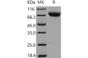 Western Blotting (WB) image for Intercellular Adhesion Molecule 1 (ICAM1) (Active) protein (His tag) (ABIN7196238)