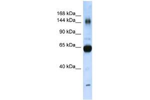 WB Suggested Anti-COL11A2 Antibody Titration:  0. (COL11A2 anticorps  (N-Term))