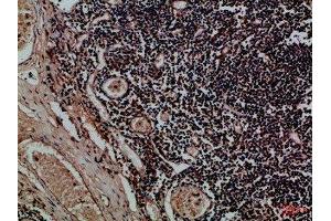 Immunohistochemical analysis of paraffin-embedded Human-tonsil, antibody was diluted at 1:100